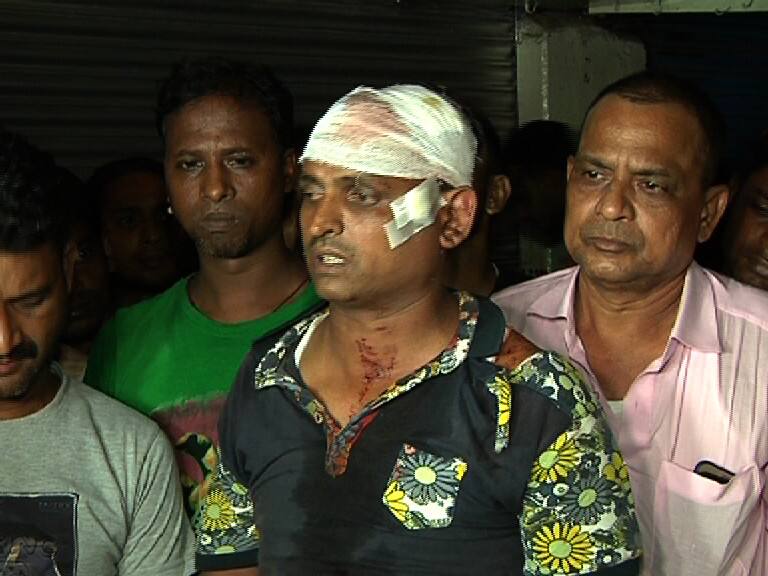 TMC-Cong clash in Metiaburuz ফ্লেক্স টাঙানো ঘিরে মেটিয়াবুরুজে কংগ্রেস-তৃণমূল সংঘর্ষ, আহত পুলিশকর্মী সহ ৫