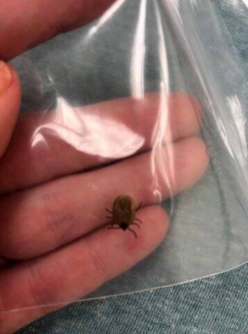 আসলে ওই পোকার কামড়ে শরীরে নিউরোটক্সিন নামে কেমিক্যাল তৈরি হয়। ওই উপাদানটি খুবই বিষাক্ত। এমন পরিস্থিতিতে মৃত্যুও হতে পারে। (ফটো-ফেসবুক)