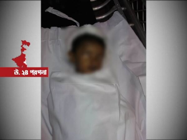 মৃত শিশুর চোখ তুলে নেওয়ার অভিযোগ এসএসকেএমের বিরুদ্ধে Dead kid’s eye stolen from SSKM মৃত শিশুর চোখ তুলে নেওয়ার অভিযোগ এসএসকেএমের বিরুদ্ধে