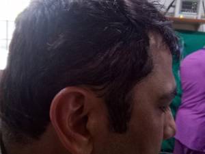 অনূর্ধ্ব-২৩ ক্রিকেটারকে দলে না নেওয়ায় আক্রান্ত দিল্লির নির্বাচক অমিত ভাণ্ডারি, ভর্তি হাসপাতালে