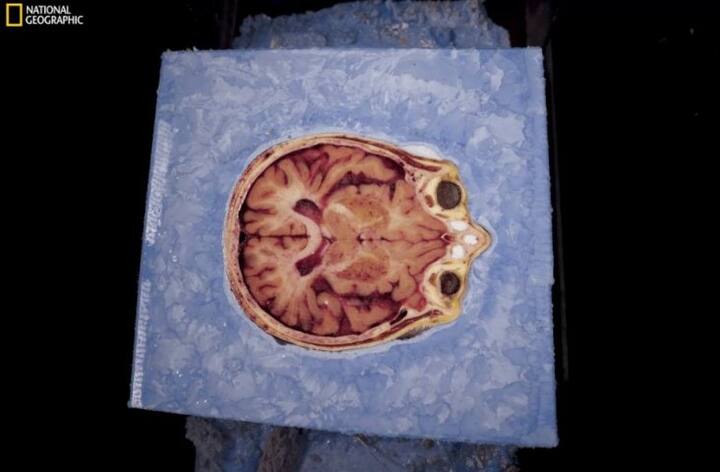 সাতাশ হাজার অংশে সুসানের শববিচ্ছেদ করা হবে। প্রত্যেকটি অংশকে কম্পিউটারের সাহায্যে আলাদাভাবে নিরীক্ষণ করা হবে।(সব ছবি- ন্যাশানাল জিওগ্রাফি)