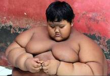 বিশ্বের সবচেয়ে \'স্থুলকায় শিশু\', তিন বছরে কমেছে ৮৬ কেজি ওজন