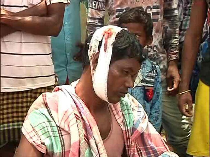 বীরভূমের সদাইপুরে সংঘর্ষ, কামারডাঙার বাসিন্দারা ভোট দিতে এলে শাসক দলের কর্মীরা তাঁদের ওপর হামলা চালায় বলে অভিযোগ, কারও ফেটেছে মাথা, কারও কেটেছে পা। কেন্দ্রীয় বাহিনী আশ্বস্ত করলেও তাঁদের প্রশ্ন, কোন ভরসায় এবার ভোটগ্রহণ কেন্দ্রে যাবেন তাঁরা।