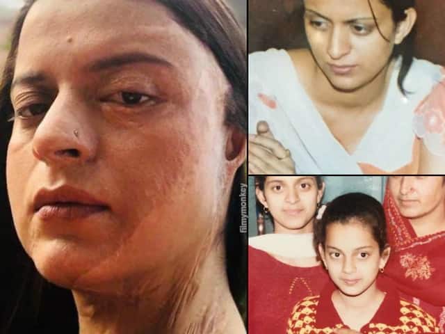 Rangoli Chandel Posts Her Throwback College Pics Right Before Acid Attack & After অ্যাসিড হানায় পুড়ে যায় মুখ, ক্ষতিগ্রস্ত হয় কান, পুরনো ছবি শেয়ার করলেন কঙ্গনার বোন