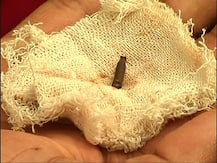 চোখে পেরেক, বাদ দিতে হল চোখ, হাসপাতালের বিরুদ্ধে চিকিৎসায় গাফিলতির অভিযোগ পরিবারের।