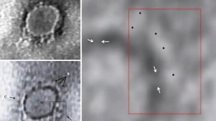 First images from India of virus causing Covid-19 captured by scientists লেন্সবন্দি করোনা ভাইরাস, ছবি তুলতে সক্ষম হলেন পুণের একদল বিজ্ঞানী