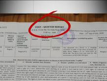 গলায় ফাঁসের দাগ একটানা নয়, বলছে ময়নাতদন্ত রিপোর্ট, খুন নয়, আত্মহত্যা করেছেন বিজেপি বিধায়ক, প্রাথমিক মত বিশেষজ্ঞদের