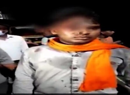 Uttarakhand: Police stab bike rider on forehead with key for not wearing helmet  ফুলস্পিডে বাইক চালানোয় আরোহীর কপাল খুঁচিয়ে চাবি ঢুকিয়ে শাস্তি, সাসপেন্ড ৩ পুলিশকর্মী