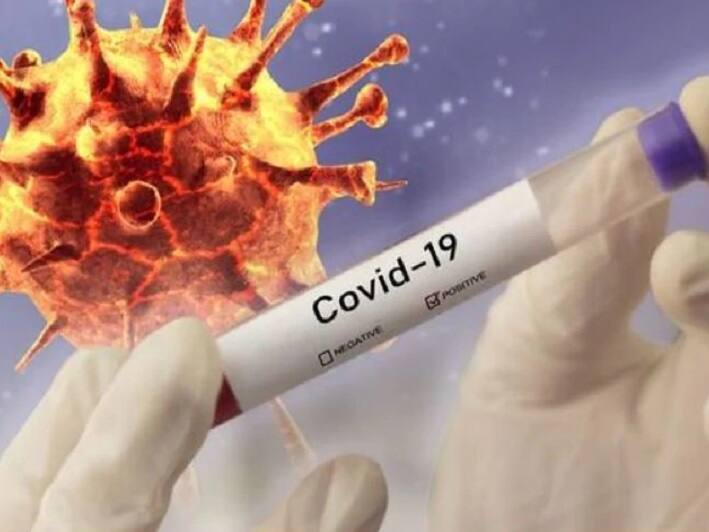 ভারতে করোনায় সুস্থতার হার বেড়ে ৬৭.৬২ শতাংশ, মৃত্যু ২.০৭ শতাংশ আক্রান্তের Indias Covid-19 recovery rate climbs to 67.62%, Case Fatality Rate at 2.07% ভারতে করোনায় সুস্থতার হার বেড়ে ৬৭.৬২ শতাংশ, মৃত্যু ২.০৭ শতাংশ আক্রান্তের