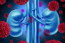 ২ করোনা-জয়ীর কিডনিতে বাঁচল একজোড়া প্রাণ, বিরল দৃষ্টান্ত রাজস্থানে