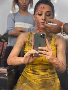 ছিন্ন-ভিন্ন পোশাক, মুখ-হাত পুড়ে দগদগে! সোশ্যাল মিডিয়ায় ছবি শেয়ার করলেন মিমি