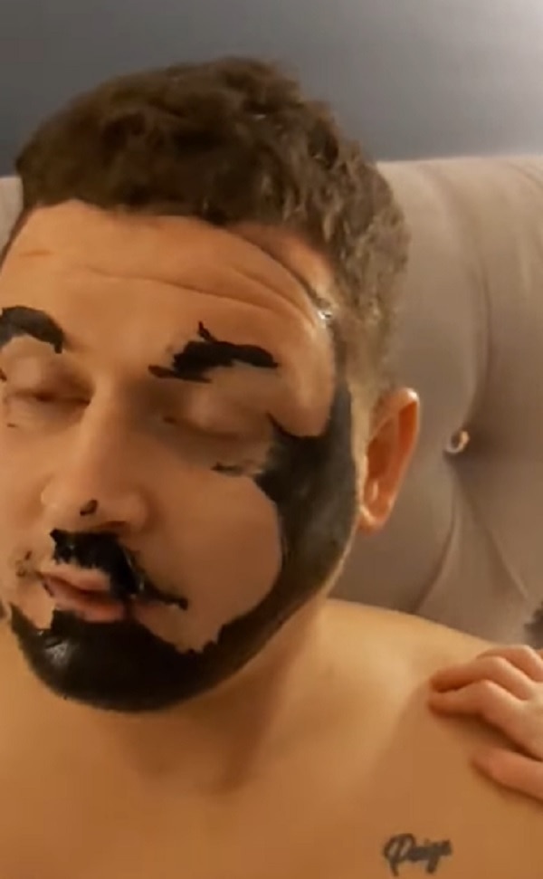 Man Is Left With No Eyebrows After Applying Charcoal Mask On His Entire Face বৌয়ের ফেসপ্যাক মাখতে গিয়ে কেলেঙ্কারি, স্কটল্যান্ডের এই যুবকের ভুরু উড়ে গেল
