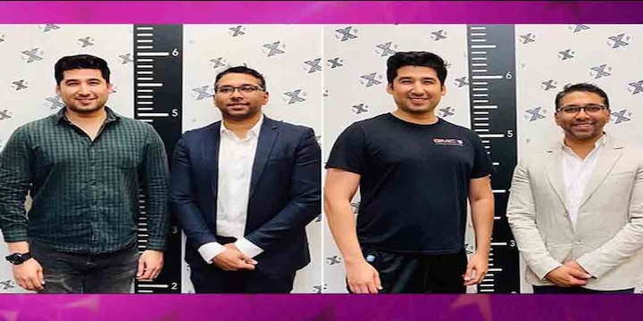 Limb lengthening procedure can help increase a person's height by six inches Limb lengthening procedure: অভাবনীয় ! ৫৫ লক্ষ টাকা খরচ করে লম্বা হলেন বছর ২৮-এর আলফোন্সো