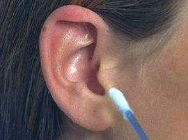 Graphic Video This Is Why You Shouldnt Push A Cotton Bud Too Far Into Your Ear Graphic Video :..म्हणून इअर बड कानात खोलवर घालू नये!
