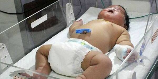 टेलिग्राफच्या रिपोर्टनुसार, या मुलीचं वजन 6 महिन्याचा बाळाच्या बरोबरीचं आहे. एवढंच नाही या मुलीचा आकार सामान्य बाळांपेक्षा जास्त आहे.