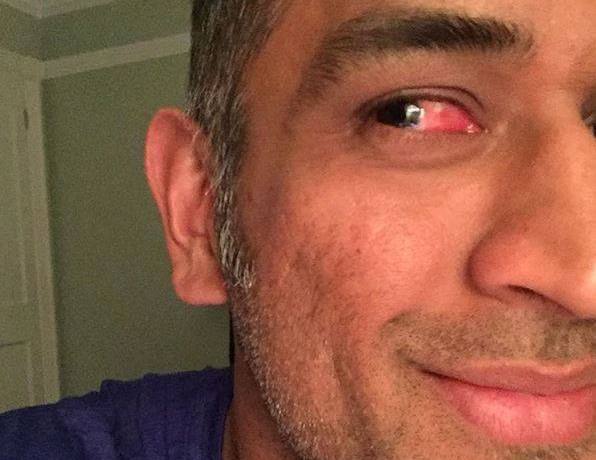 आज कर्णधार धोनीनं एक फोटो अपलोड केला. ज्यामध्ये धोनीचा एक डोळा पूर्णपणे लाल झालेला पाहायला मिळाला. या फोटोसोबत धोनीनं लिहलं की, 'तुमच्या डोळ्याला बेल्स लागल्यानंतर असं होतं. नशीबानं मला फार दुखापतीमध्ये विकेटकिपिंग करावं लागलं नाही.'