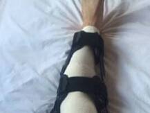 सचिन तेंडुलकरच्या गुडघ्यावर लंडनमध्ये शस्त्रक्रिया