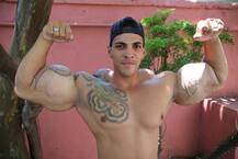 मिनरल ऑईलच्या इंजेक्शनने बाझीलच्या एका शरीरसौष्ठवपटूचे स्वप्न साकार