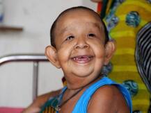 चार वर्षाच्या मुलाला अकाली वृद्धत्व