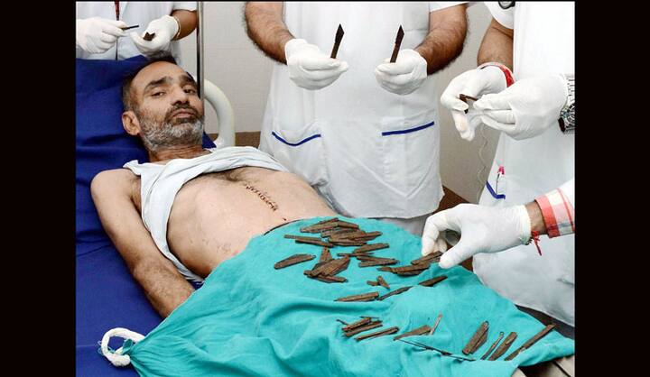 पंजाबमध्ये सर्वांनाच धक्का देणारी घडना घडली आहे. हृदय पिळवटून टाकणाऱ्या या घटनेत चक्क एका पोलिसाच्या पोटातून 40 चाकू बाहेर काढण्यात आले आहेत. या पोलिसाच्या मते त्याला चाकू खाण्याची भूक होती.