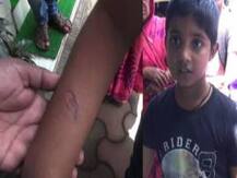 मस्ती केल्यामुळे विद्यार्थ्याला गरम चाकूने चटके, शिक्षिकेचा प्रताप