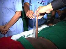 खरोखरची शेपटी असलेला माणूस