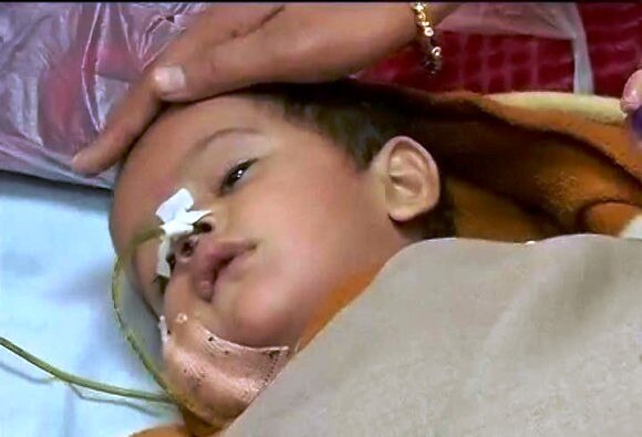 14 Month Old Pari Got Injured In Shelling By Pakistan Condition Is Serious अंगणात खेळणाऱ्या परीवर पाककडून गोळीबार, छर्र्यांनी शरीराची चाळण