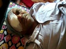 बदलापुरात मद्यधुंद टोळक्याने पोलिसाचा डोळा फोडला!