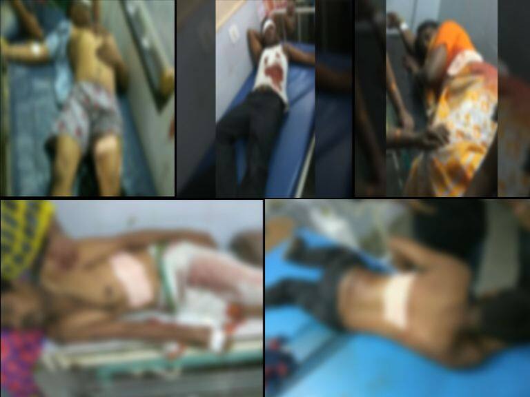 Police Attacked On 7 Peoples In Parbhani परभणीत पोलिसाकडून रागाच्या भरात 7 जणांवर चाकूहल्ला