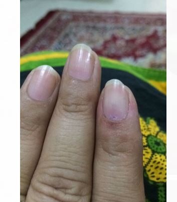 Pune Municipal Election Ink Washout हात धुतल्यावर लगेचच बोटाची शाई गेली