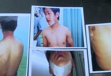 बंगळुरुत विद्यार्थ्याला बेदम मारहाण करुन चपला चाटायला सांगितलं !