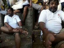 आत्मक्लेश यात्रेत राजू शेट्टींच्या पायांना सूज आणि फोड!