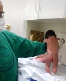 VIDEO :...आणि जन्म होताच बाळ चालायला लागलं!