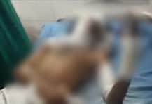 दाढी न केल्याने संताप, पत्नीने पतीवर उकळतं पाणी ओतलं!