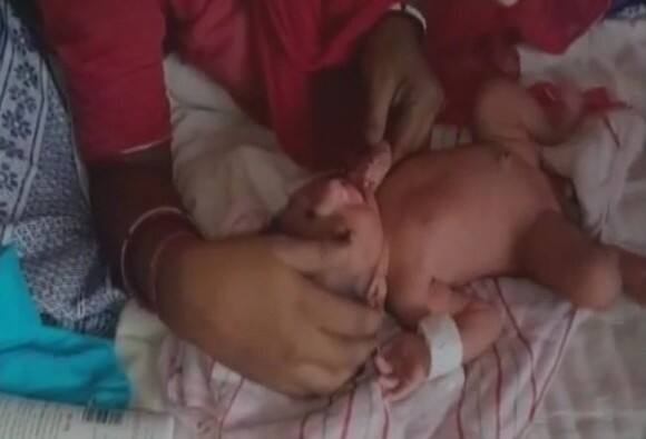सरकारी रुग्णालयात उंदराने नवजात बाळाची बोटं कुरतडली Rats Nibble Four Day Old Babys Fingers At A Hospital In Rajasthans Banswara Latest Updates सरकारी रुग्णालयात उंदराने नवजात बाळाची बोटं कुरतडली
