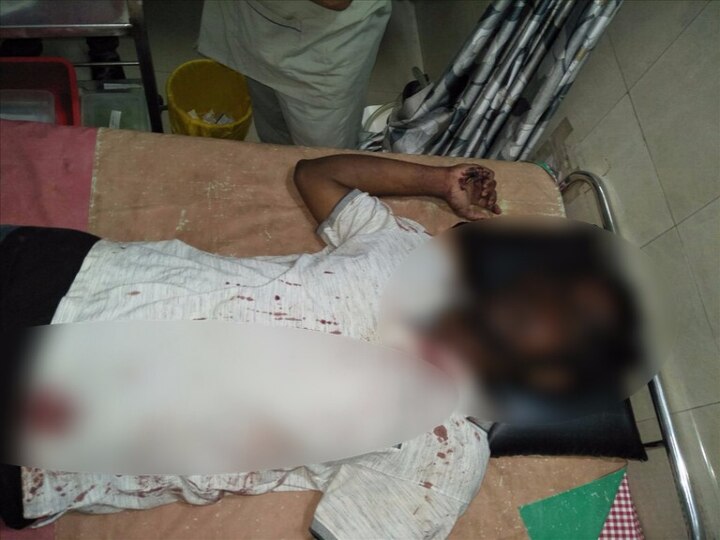 Traveller Beaten Up By Private Cab Driver And Looted Latest Updates मुंबई-पुणे एक्स्प्रेस वेवर प्रवाशाला बेदम मारहाण करुन लूटलं