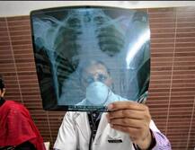 मुंबईत डेंग्यूचे रुग्ण 265% नी वाढले, टीबीचे रोज 18 बळी