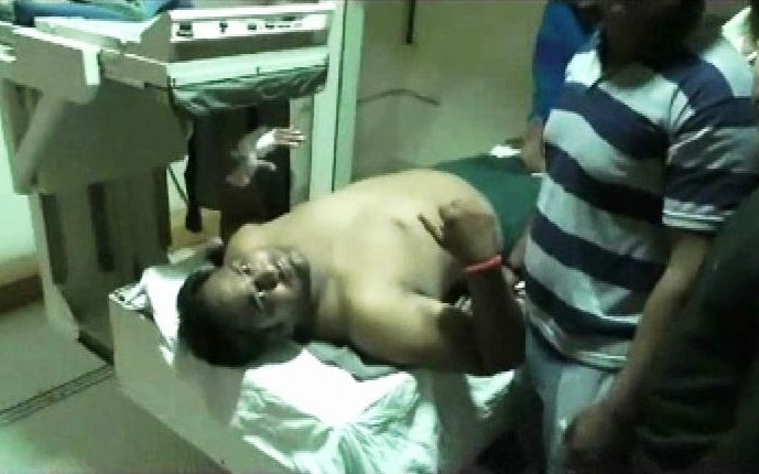 Ahmednagar A Man Shot By Congress Corporator अहमदनगरमध्ये काँग्रेस नगरसेवकाचा तरुणावर गोळीबार