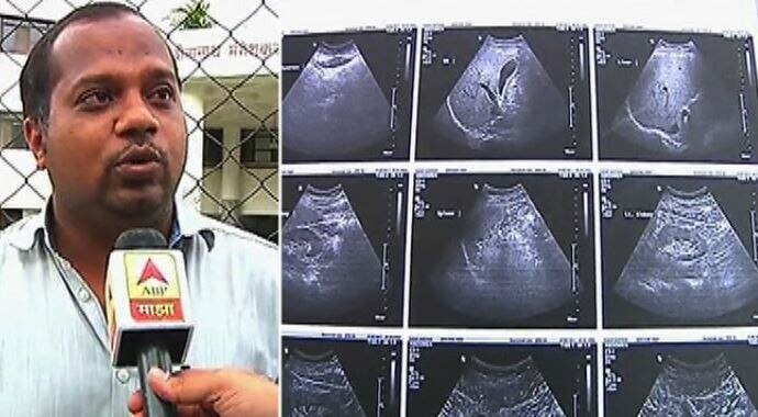 Man Is Pregnant The Shocking Report Of The Deenanath Mangeshkar Hospital Latest Update पुरुषाच्या पोटात गर्भाशय असल्याचा अहवाल, रुग्णालयाचा भोंगळ कारभार