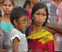 पिंपरीत तीन वर्षीय चिमुकल्याला कोचिंग क्लासच्या शिक्षिकेची अमानुष मारहाण