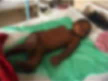 बोबडं बोलल्याने चिमुकल्याला सावत्र पित्याकडून 40 चटके