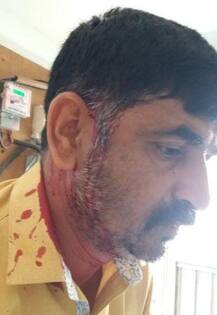 सांगली : वाटेगाव ग्रामपंचायत निवडणुकीत मतदान केंद्राबाहेर दगडफेक