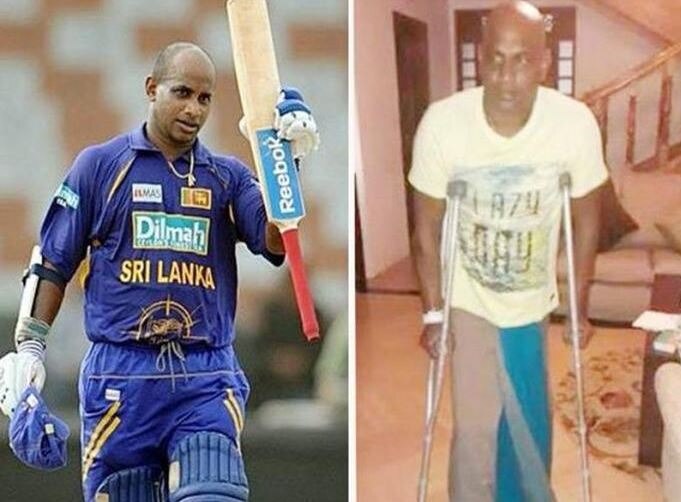 sanath jayasuriya unable to walk without crutches latest update जयसूर्याची अवस्था बिकट, कुबड्यांशिवाय चालता येईना!