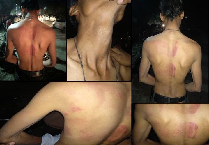 Police beats AAP worker in Latur लातुरात पोलिसाची अरेरावी, ‘आप’च्या कार्यकर्त्याला अमानुष मारहाण