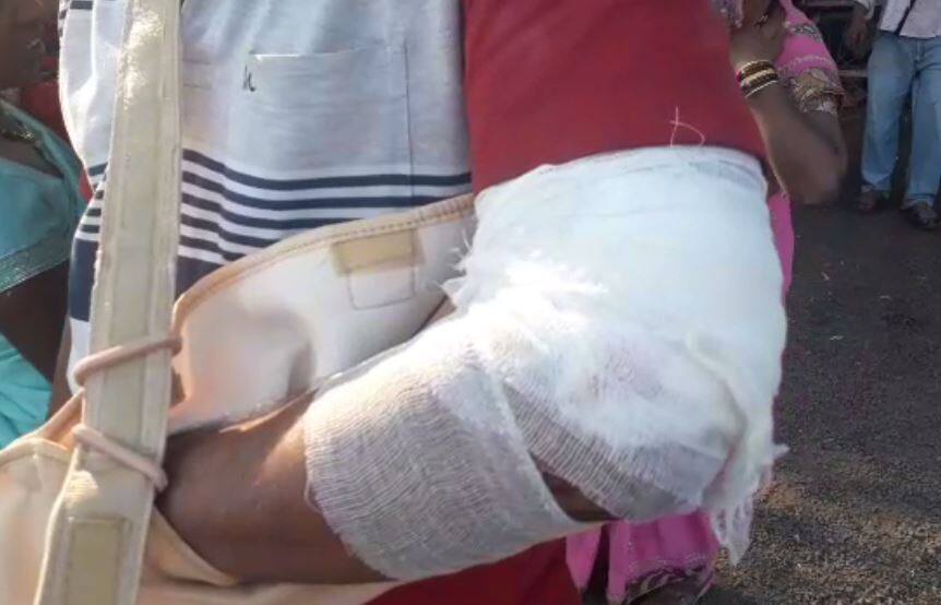 नागपूर-कोल्हापूर एक्स्प्रेसमध्ये खिडकीतील प्रवाशांचे हात कापले Sangli : Hands of Nagpur-Kolhapur Express Commuters cut due to iron plate नागपूर-कोल्हापूर एक्स्प्रेसमध्ये खिडकीतील प्रवाशांचे हात कापले