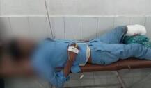 डॉक्टरांचा असंवेदनशीलतेचा कळस, तुटलेल्या पायाची रुग्णाला उशी