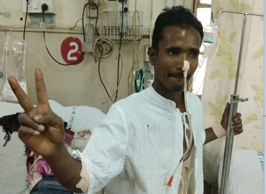 Mumbai : iron rod stuck inside body of construction worker removed by JJ Hospital doctors latest update बांधकाम मजुराच्या पोटात घुसलेली सळी काढून जीवदान