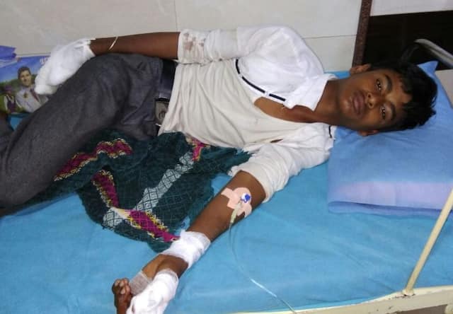 चार्जिंगवेळी मोबाईल बॅटरीचा स्फोट, तरुणाची बोटं रक्तबंबाळ