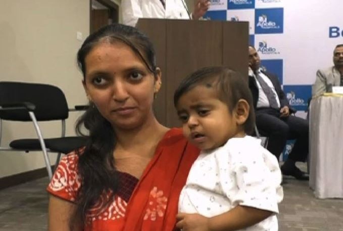 1-year-old boy from Gujarat undergoes liver transplant in Navi Mumbais Apollo Hospital 1 वर्षाच्या बाळावर लिव्हर ट्रान्सप्लांट शस्त्रक्रिया