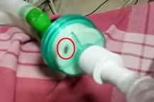 व्हेंटिलेटरमध्ये झुरळ अडकलं, नाशिकमध्ये रुग्णाचा मृत्यू